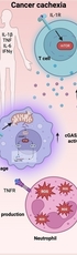 Targeting immunometabolism in cancer