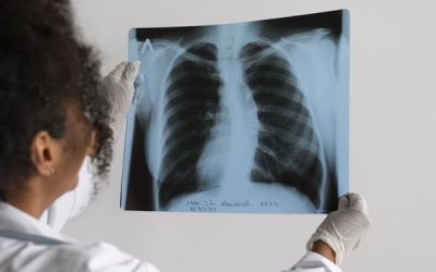 side-view-doctor-looking-radiography_